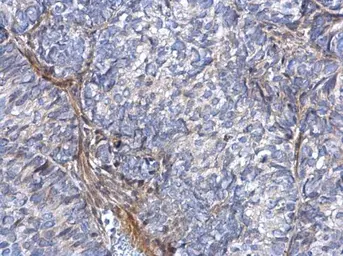 Anti-COL1A1 antibody [N1N2], N-term used in IHC (Paraffin sections) (IHC-P). GTX112731