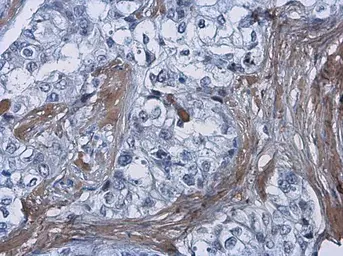 Anti-COL1A1 antibody [N1N2], N-term used in IHC (Paraffin sections) (IHC-P). GTX112731