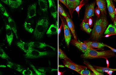 Anti-COL1A1 antibody [N1N2], N-term used in Immunocytochemistry/ Immunofluorescence (ICC/IF). GTX112731