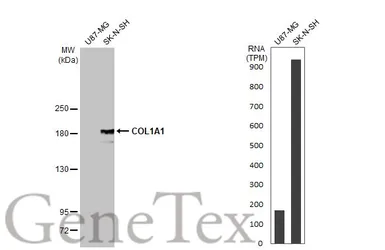 Anti-COL1A1 antibody [N1N2], N-term used in Western Blot (WB). GTX112731