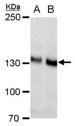 Anti-N-Cadherin antibody [N1N3] used in Western Blot (WB). GTX112734