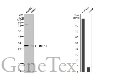 Anti-BCL10 antibody used in Western Blot (WB). GTX112744