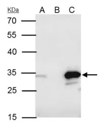 Anti-BCL10 antibody used in Immunoprecipitation (IP). GTX112744