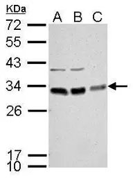 Anti-BCL10 antibody used in Western Blot (WB). GTX112744