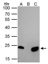Anti-mtTFA antibody used in Immunoprecipitation (IP). GTX112760