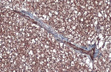 Anti-UCP1 antibody used in IHC (Paraffin sections) (IHC-P). GTX112784