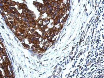 Anti-KIR2DS4 antibody [N1C3-2] used in IHC (Paraffin sections) (IHC-P). GTX112787
