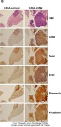 Anti-Fibronectin antibody [N1N2], N-term used in IHC (Paraffin sections) (IHC-P). GTX112794