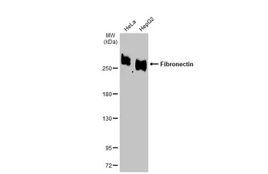Anti-Fibronectin antibody [N1N2], N-term used in Western Blot (WB). GTX112794