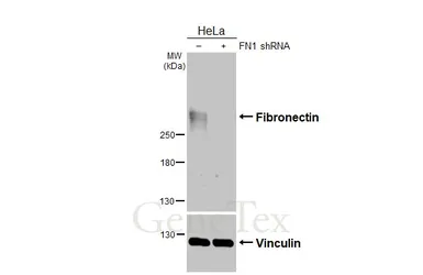 Anti-Fibronectin antibody [N1N2], N-term used in Western Blot (WB). GTX112794