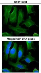 Anti-Fibronectin antibody [N1N2], N-term used in Immunocytochemistry/ Immunofluorescence (ICC/IF). GTX112794
