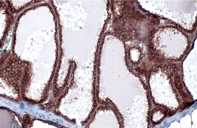 Anti-Cytokeratin 19 antibody [N1C1] used in IHC (Paraffin sections) (IHC-P). GTX112826