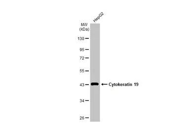 Anti-Cytokeratin 19 antibody [N1C1] used in Western Blot (WB). GTX112826