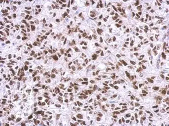 Anti-PARP antibody [N1N2], N-term used in IHC (Paraffin sections) (IHC-P). GTX112839