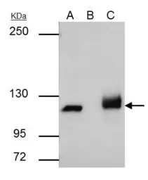 Anti-PARP antibody [N1N2], N-term used in Immunoprecipitation (IP). GTX112839