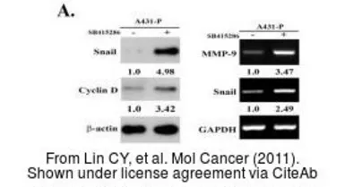 Anti-Cyclin D1 antibody [N2C3] used in Western Blot (WB). GTX112874