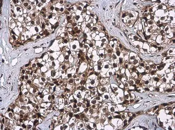 Anti-Cyclin D1 antibody [N2C3] used in IHC (Paraffin sections) (IHC-P). GTX112874