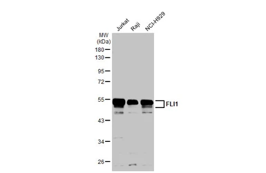 Anti-FLI1 antibody used in Western Blot (WB). GTX112937