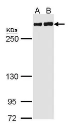 Anti-Filamin A antibody [C2], C-term used in Western Blot (WB). GTX112939
