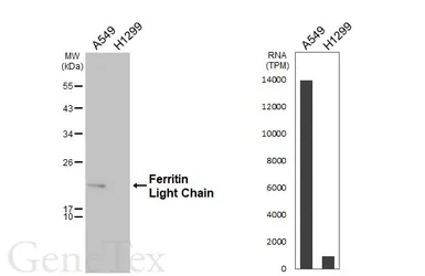 Anti-Ferritin Light Chain antibody [N1C3-3] used in Western Blot (WB). GTX112943