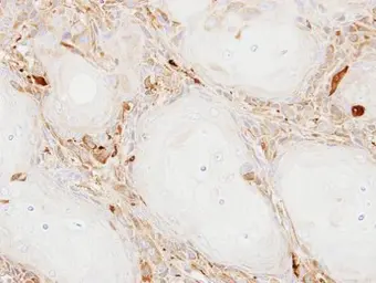 Anti-Ferritin Light Chain antibody [N1C3-3] used in IHC (Paraffin sections) (IHC-P). GTX112943