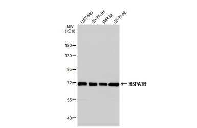 Anti-Hsp70 antibody used in Western Blot (WB). GTX112963