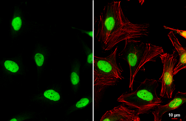 Anti-c-Jun antibody used in Immunocytochemistry/ Immunofluorescence (ICC/IF). GTX112974