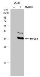 Anti-MyD88 antibody used in Western Blot (WB). GTX112986
