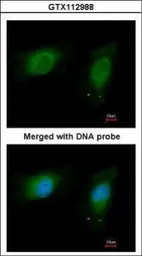 Anti-nm23-H1 antibody [N1C3] used in Immunocytochemistry/ Immunofluorescence (ICC/IF). GTX112988
