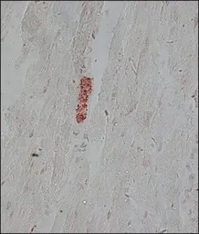Anti-alpha Tubulin antibody [DM1A] used in IHC (Paraffin sections) (IHC-P). GTX11302