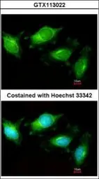 Anti-TLR3 antibody used in Immunocytochemistry/ Immunofluorescence (ICC/IF). GTX113022