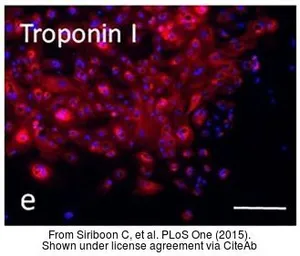 Anti-Cardiac Troponin I antibody [N1C3-3] used in Immunocytochemistry/ Immunofluorescence (ICC/IF). GTX113028