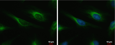 Anti-Cardiac Troponin I antibody [N1C3-3] used in Immunocytochemistry/ Immunofluorescence (ICC/IF). GTX113028