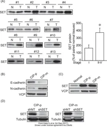 Anti-VCP antibody [N1N2], N-term used in Western Blot (WB). GTX113030
