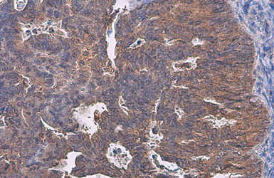 Anti-TRADD antibody [N2C3] used in IHC (Paraffin sections) (IHC-P). GTX113042