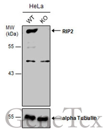 Anti-RIP2 antibody [C1C3] used in Western Blot (WB). GTX113045