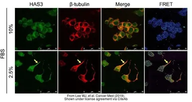 Anti-beta Tubulin antibody [D66] used in Immunocytochemistry/ Immunofluorescence (ICC/IF). GTX11307