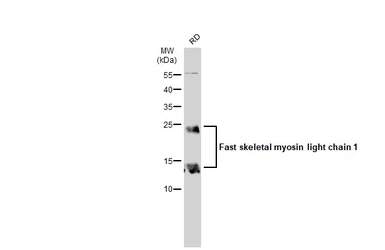 Anti-Fast skeletal myosin light chain 1 antibody used in Western Blot (WB). GTX113092
