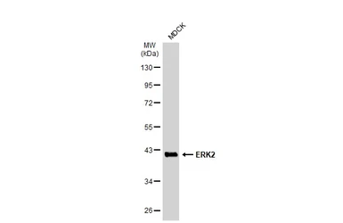 Anti-ERK2 antibody [N2C3] used in Western Blot (WB). GTX113094