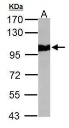 Anti-VCP antibody [N3C2], Internal used in Western Blot (WB). GTX113099