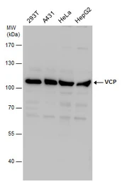 Anti-VCP antibody [N3C2], Internal used in Western Blot (WB). GTX113099
