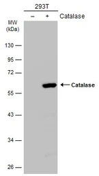 Anti-Catalase antibody [N2C1], Internal used in Western Blot (WB). GTX113149