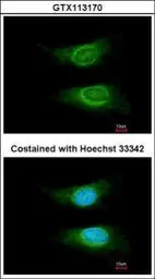Anti-CD55 antibody [N1C2] used in Immunocytochemistry/ Immunofluorescence (ICC/IF). GTX113170