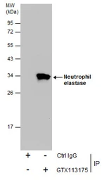 Anti-Neutrophil elastase antibody [N2C3] used in Immunoprecipitation (IP). GTX113175