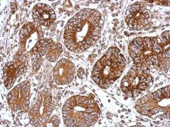 Anti-GNAS antibody [C2C3-2], C-term used in IHC (Paraffin sections) (IHC-P). GTX113200
