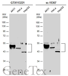 Anti-Cytokeratin 10 antibody used in Western Blot (WB). GTX113221