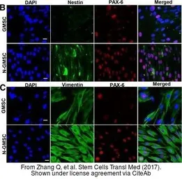 Anti-PAX6 antibody used in Immunocytochemistry/ Immunofluorescence (ICC/IF). GTX113241