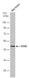Anti-PAX6 antibody used in Western Blot (WB). GTX113241