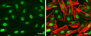 Anti-PAX6 antibody used in Immunocytochemistry/ Immunofluorescence (ICC/IF). GTX113241