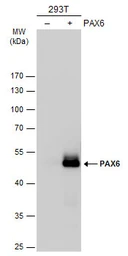 Anti-PAX6 antibody used in Western Blot (WB). GTX113241